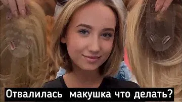 Накладка на макушку