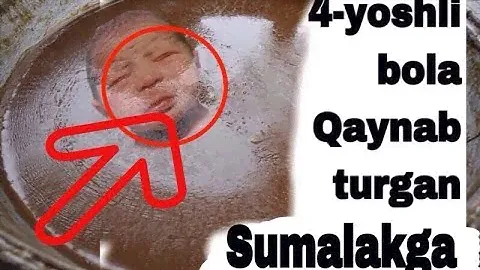 4-yoshli bola qaynab turgan sumalakga tushib ketdi